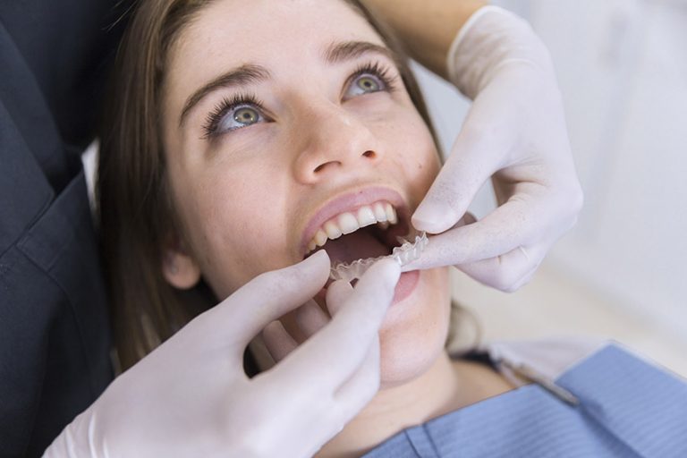 Cât costă un implant dentar?